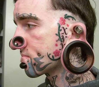 1-analit1-medasavlet